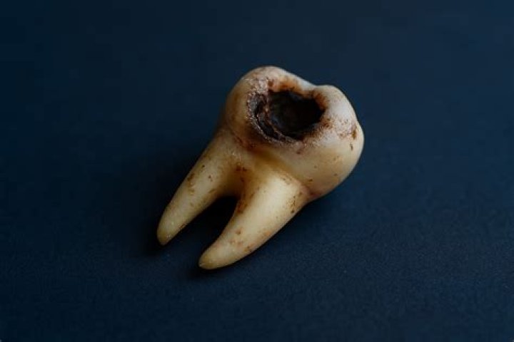 
Miles Wood Teeth – How Did His Tooth Fall Out? Injury Update 