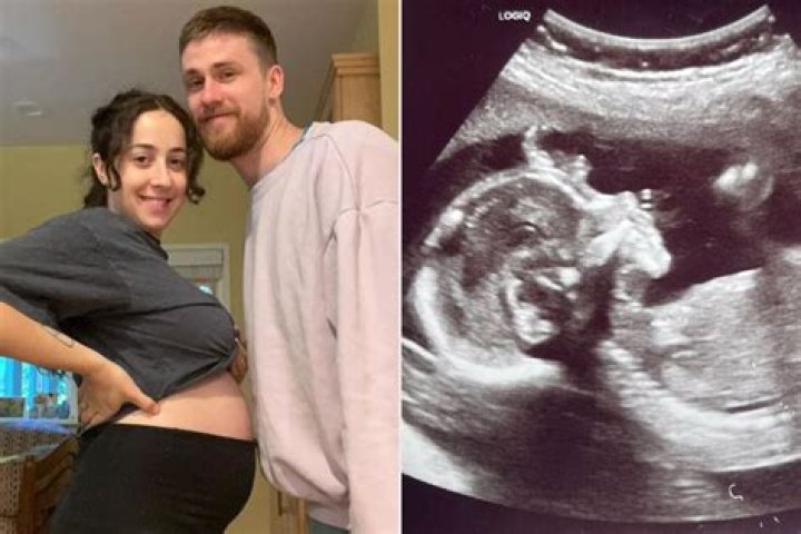 
Singer Still Woozy Wife Pregnant in 2023, Who is Still Woozy Wife? 
